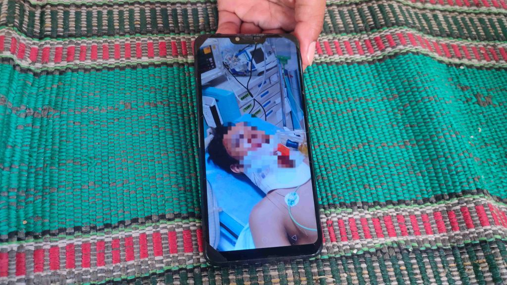 Sempat Koma 4 Hari, Pemuda Surabaya Tewas Akibat Diduga Dikeroyok Gangster