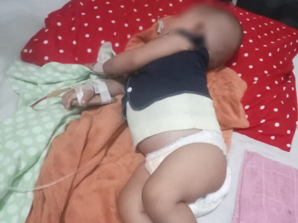 Tolong, Bayi Penderita Hernia dan Usus Bocor di Jember Butuh Bantuan