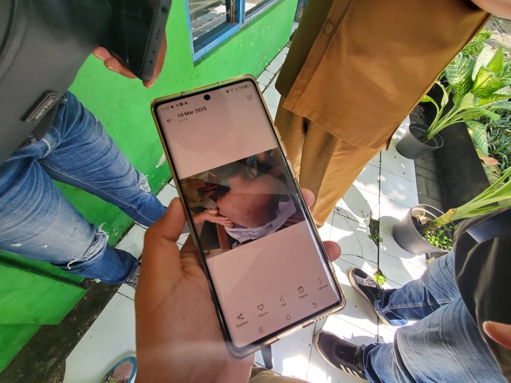 Bocah SD Mojokerto Diduga Dianiaya Ayah Tiri, Luka di Kepala Jadi Petunjuk
