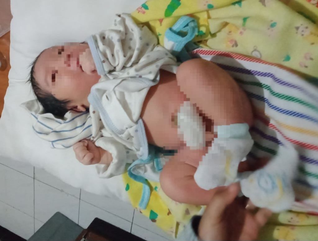 Bayi Laki-laki Dibuang Depan Panti Asuhan Imanuel Surabaya, Polisi Buru Pelaku