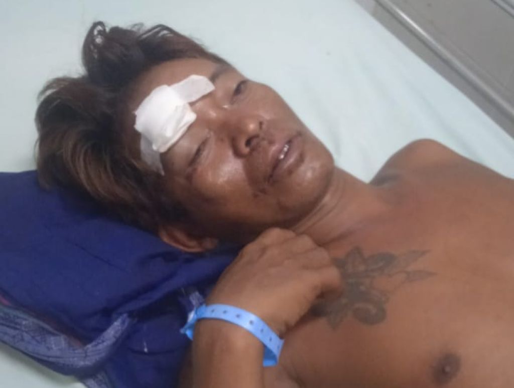 Diduga Keroyok Warga, Kadus di Situbondo Dipolisikan