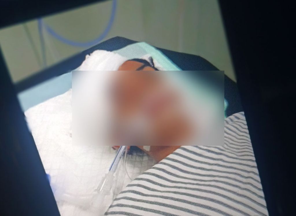 Satu dari Dua Remaja yang Dibacok Kelompok Tak Dikenal di Surabaya Kritis
