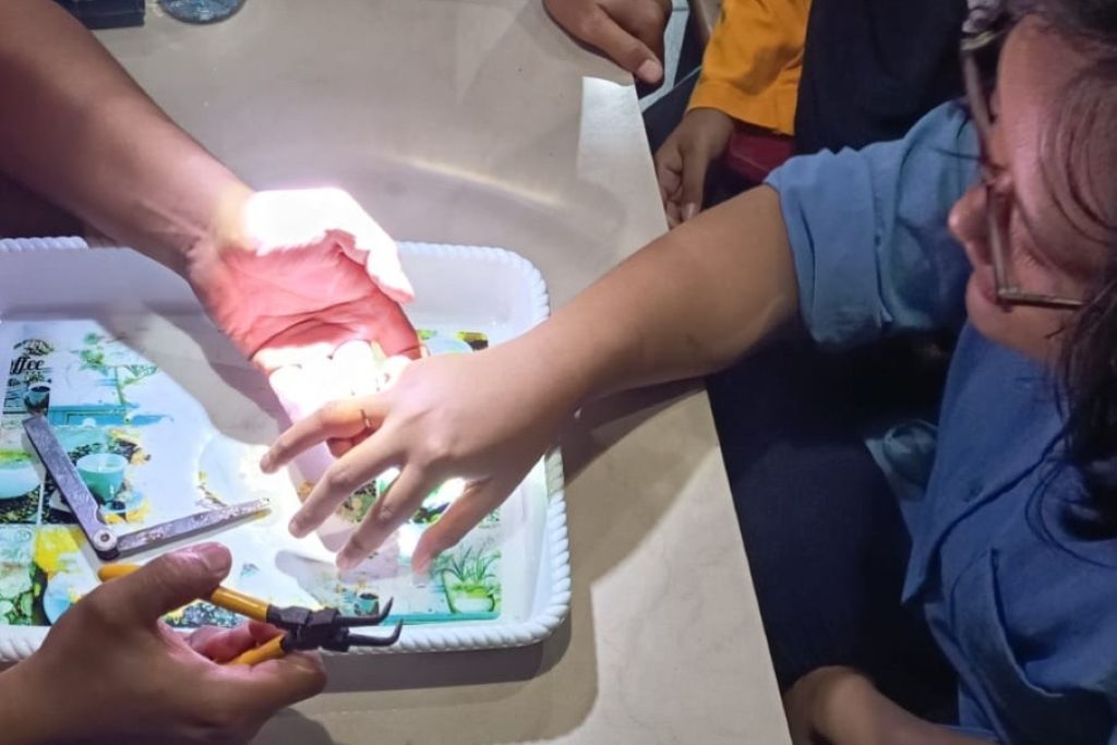 Petugas Damkar Surabaya Evakuasi Cincin Monel Menjerat Jari Kharisma